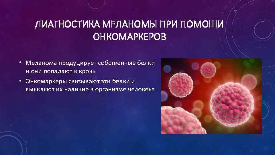 ДИАГНОСТИКА МЕЛАНОМЫ ПРИ ПОМОЩИ ОНКОМАРКЕРОВ • Меланома продуцирует собственные белки и они попадают в
