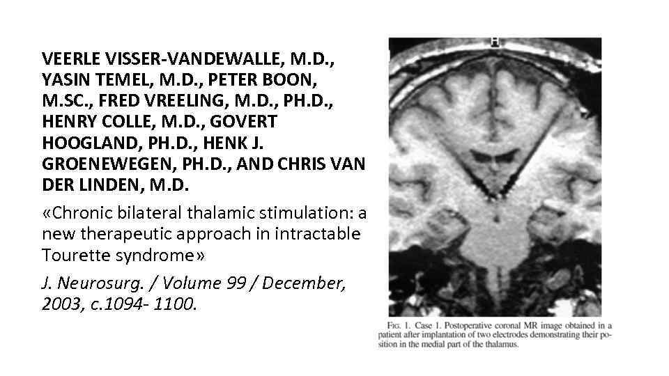 VEERLE VISSER-VANDEWALLE, M. D. , YASIN TEMEL, M. D. , PETER BOON, M. SC.