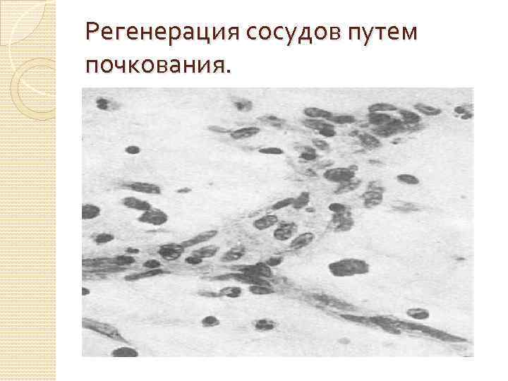 Регенерация сосудов путем почкования. 