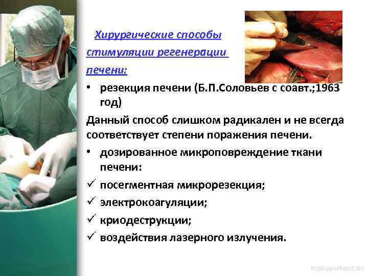 Хирургические способы стимуляции регенерации печени: • резекция печени (Б. П. Соловьев с соавт. ;
