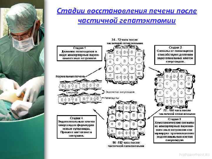 Стадии восстановления печени после частичной гепатэктомии Pro. Power. Point. Ru 