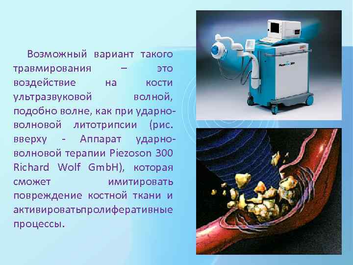 Возможный вариант такого травмирования – это воздействие на кости ультразвуковой волной, подобно волне, как