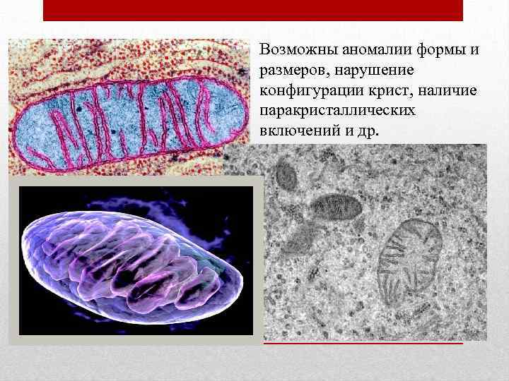 Возможны аномалии формы и размеров, нарушение конфигурации крист, наличие паракристаллических включений и др. 
