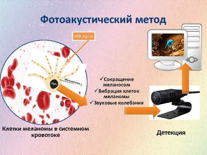 Фотоакустический метод УФ-лучи üСокращение меланосом üВибрация клеток меланомы üЗвуковые колебания Клетки меланомы в системном