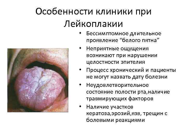 Особенности клиники при Лейкоплакии • Бессимптомное длительное проявление “белого пятна” • Неприятные ощущения возникают