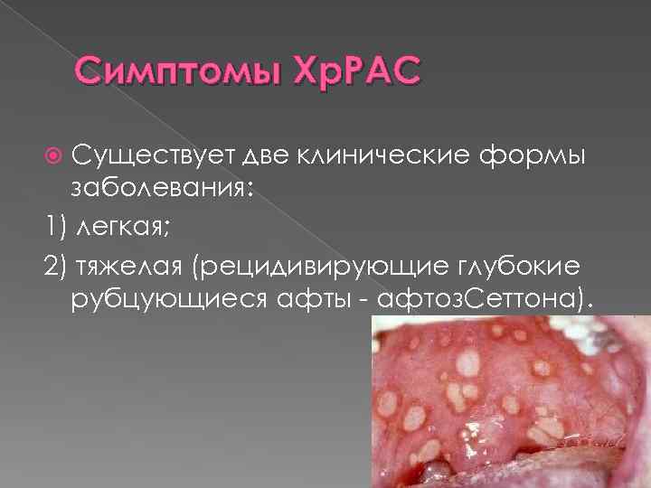Симптомы Хр. РАС Существует две клинические формы заболевания: 1) легкая; 2) тяжелая (рецидивирующие глубокие