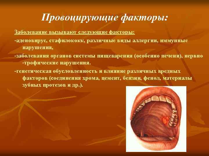 Хронический рецидивирующий афтозный стоматит фото