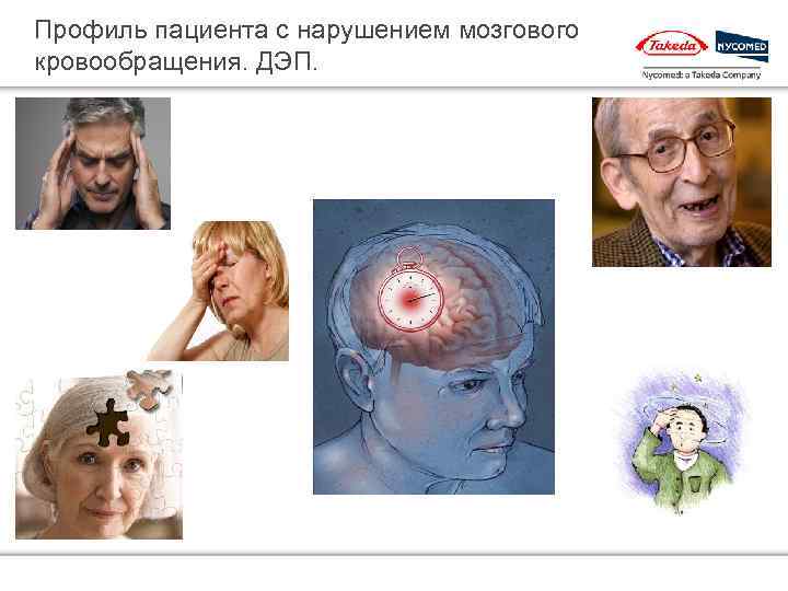 Профиль пациента с нарушением мозгового кровообращения. ДЭП. 