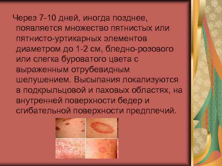 Через 7 -10 дней, иногда позднее, появляется множество пятнистых или пятнисто-уртикарных элементов диаметром до
