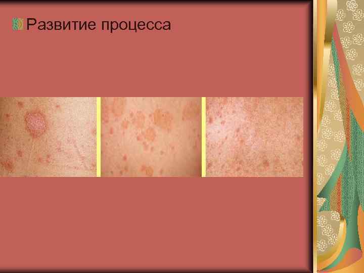 Развитие процесса 