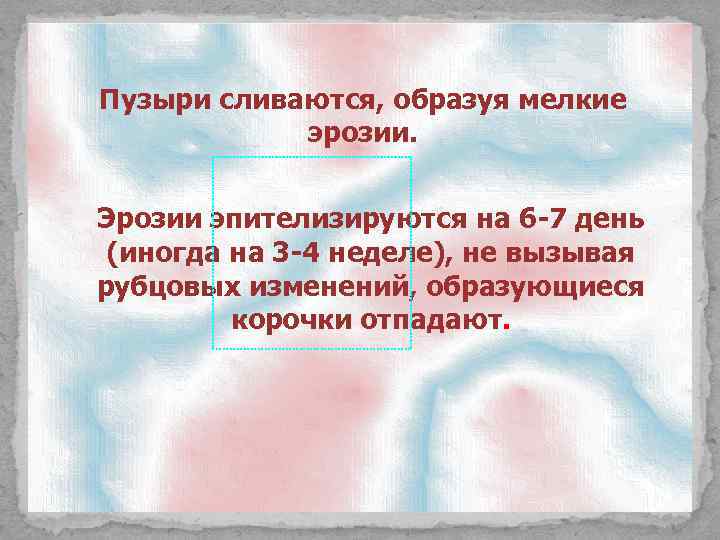Пузыри сливаются, образуя мелкие эрозии. Эрозии эпителизируются на 6 -7 день (иногда на 3