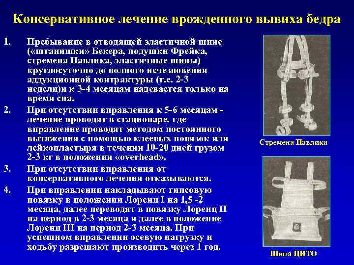 Консервативное лечение врожденного вывиха бедра 1. 2. 3. 4. Пребывание в отводящей эластичной шине