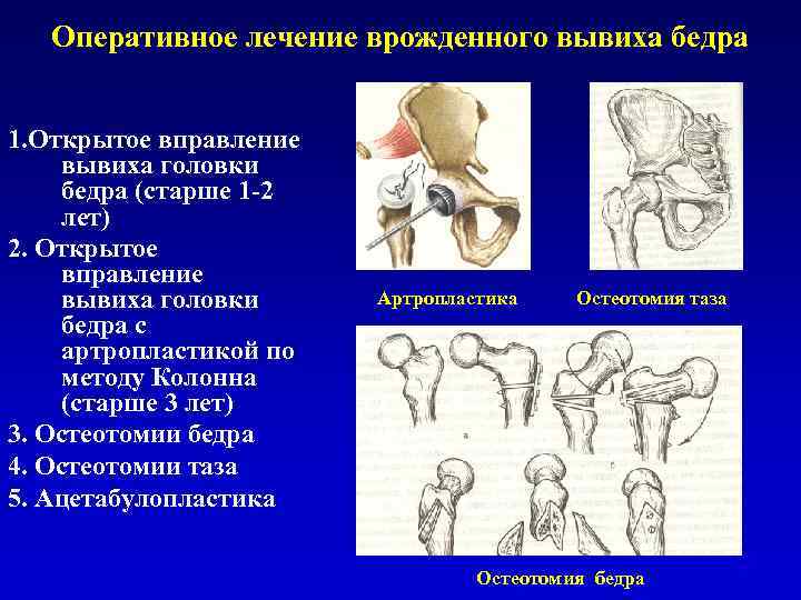 Липодерматосклероз фото и лечение