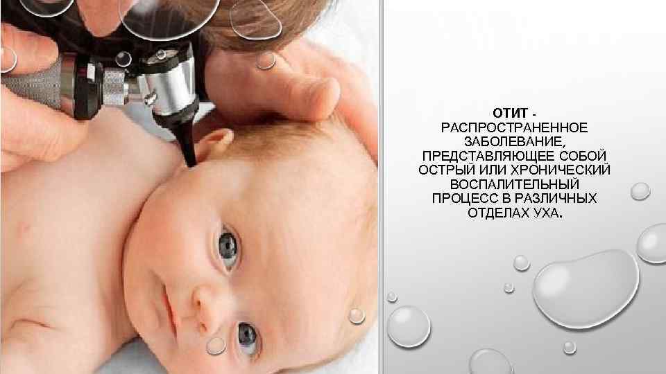 ОТИТ РАСПРОСТРАНЕННОЕ ЗАБОЛЕВАНИЕ, ПРЕДСТАВЛЯЮЩЕЕ СОБОЙ ОСТРЫЙ ИЛИ ХРОНИЧЕСКИЙ ВОСПАЛИТЕЛЬНЫЙ ПРОЦЕСС В РАЗЛИЧНЫХ ОТДЕЛАХ УХА.