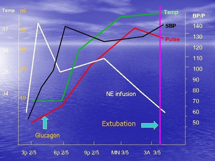 Temp ml 37 40 Temp BP/P 140 Pulse 36 SBP 130 120 30 110