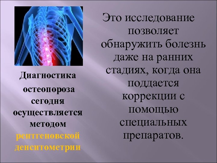 Диагностика остеопороза сегодня осуществляется методом рентгеновской денситометрии Это исследование позволяет обнаружить болезнь даже на