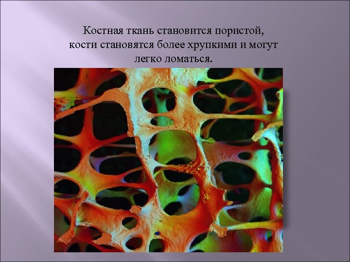 Костная ткань становится пористой, кости становятся более хрупкими и могут легко ломаться. 