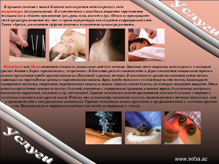 В процессе лечения в нашей Клинике используются методы разного вида акупунктуры (иглоукалывания). В соответствии