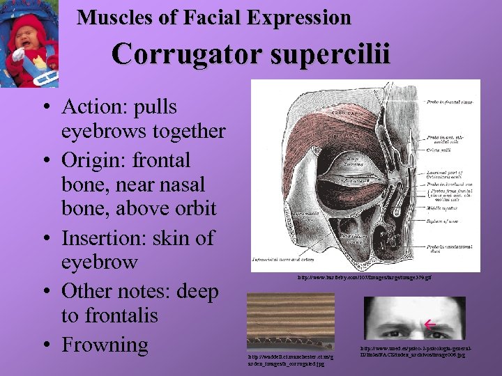 Muscles of Facial Expression Corrugator supercilii • Action: pulls eyebrows together • Origin: frontal