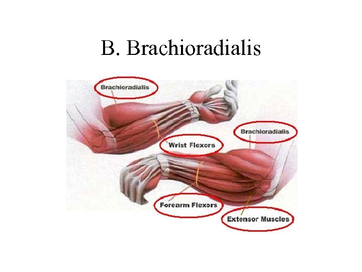 B. Brachioradialis 