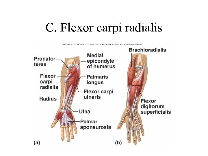 C. Flexor carpi radialis 