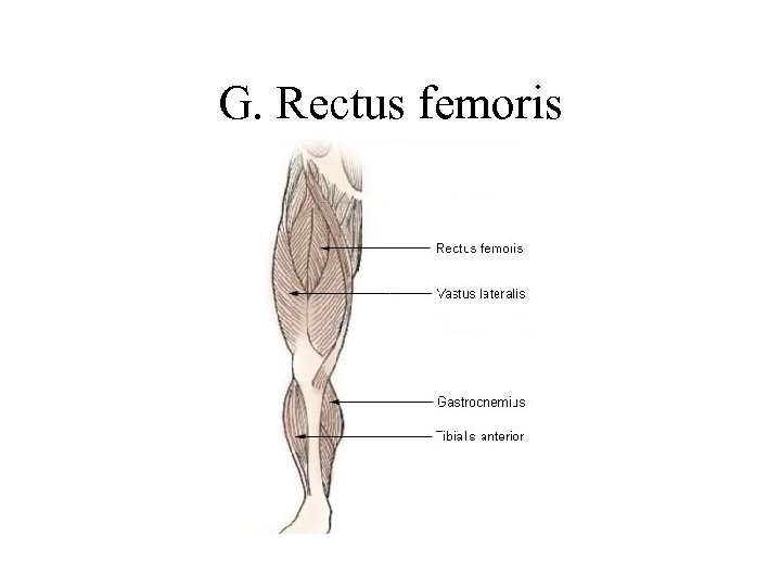 G. Rectus femoris 