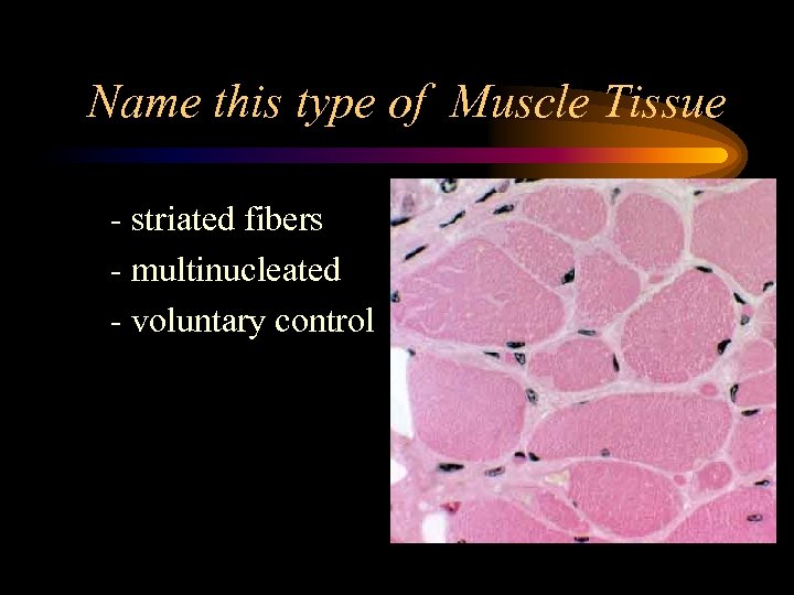 Name this type of Muscle Tissue striated fibers multinucleated voluntary control 