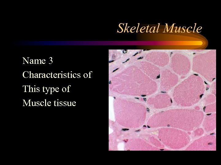 Skeletal Muscle Name 3 Characteristics of This type of Muscle tissue 