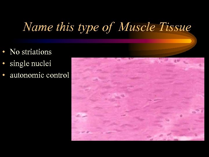 Name this type of Muscle Tissue • No striations • single nuclei • autonomic