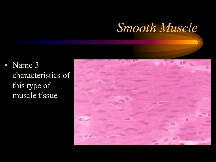 Smooth Muscle • Name 3 characteristics of this type of muscle tissue 