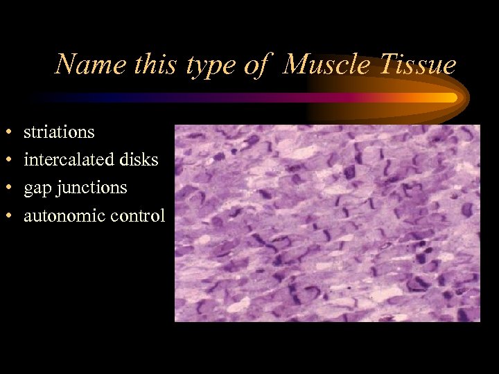 Name this type of Muscle Tissue • • striations intercalated disks gap junctions autonomic