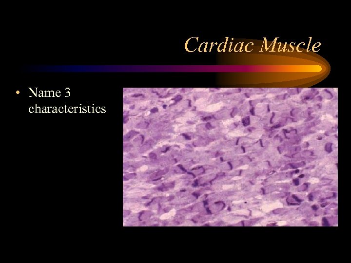 Cardiac Muscle • Name 3 characteristics 