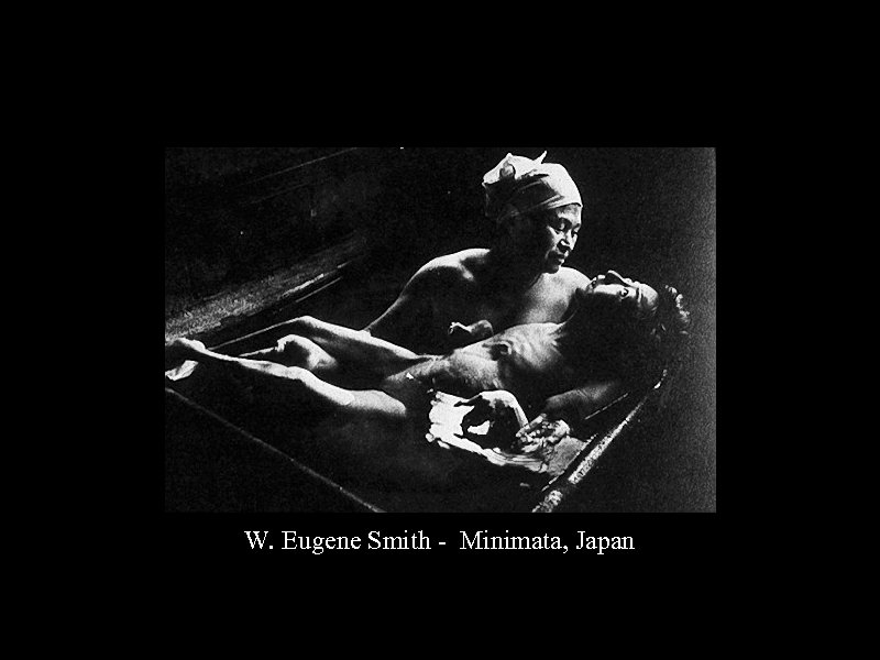 W. Eugene Smith - Minimata, Japan 