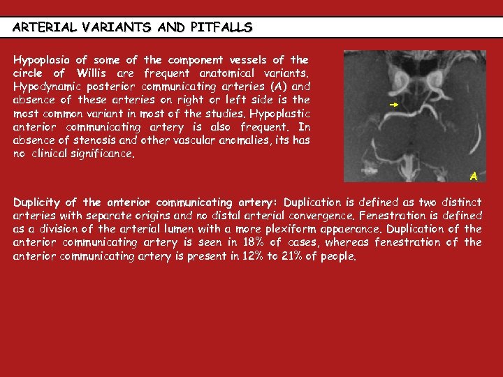 ARTERIAL VARIANTS AND PITFALLS Hypoplasia of some of the component vessels of the circle