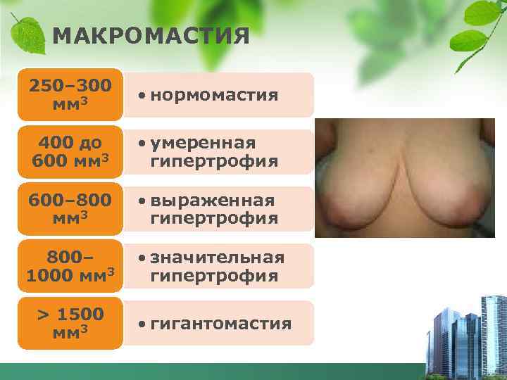 МАКРОМАСТИЯ 250– 300 мм 3 • нормомастия 400 до 600 мм 3 • умеренная