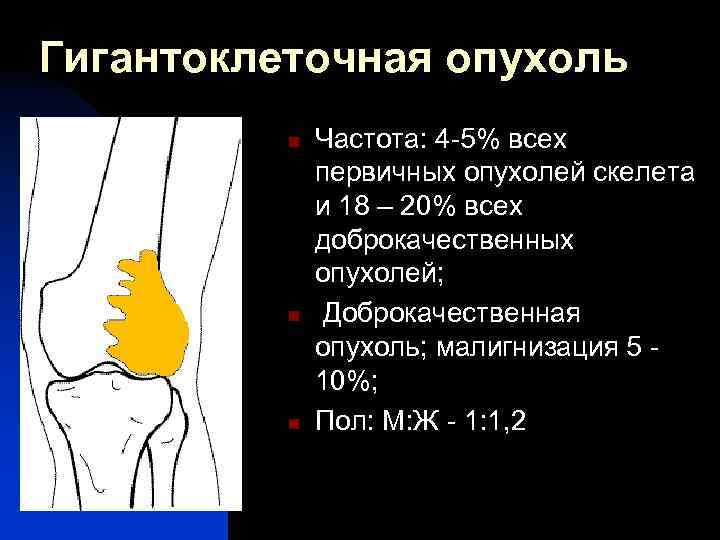 Рентгенологическая картина гигантоклеточной опухоли характеризуется разновидностями