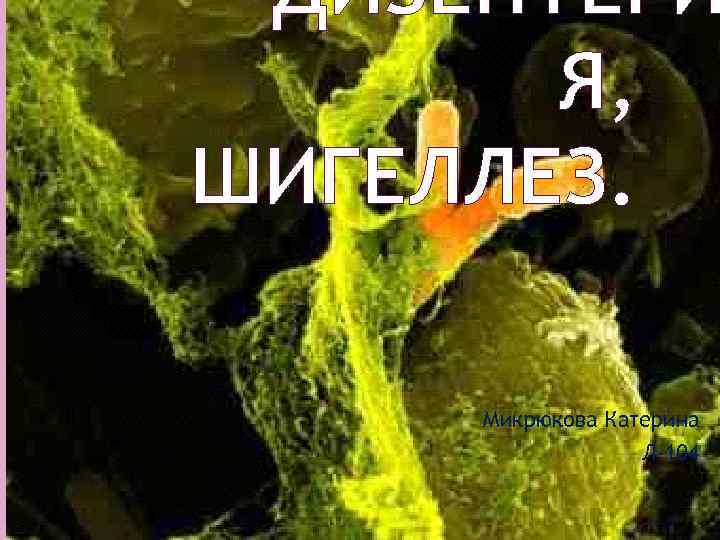 ДИЗЕНТЕРИ Я, ШИГЕЛЛЕЗ. Микрюкова Катерина Л-104 