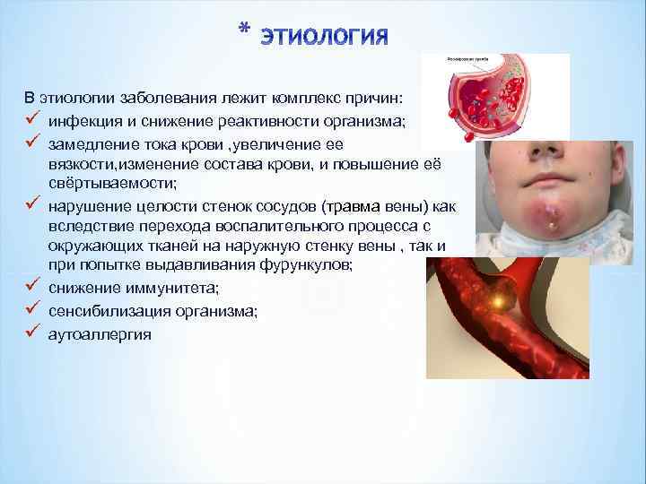 * В этиологии заболевания лежит комплекс причин: ü инфекция и снижение реактивности организма; ü