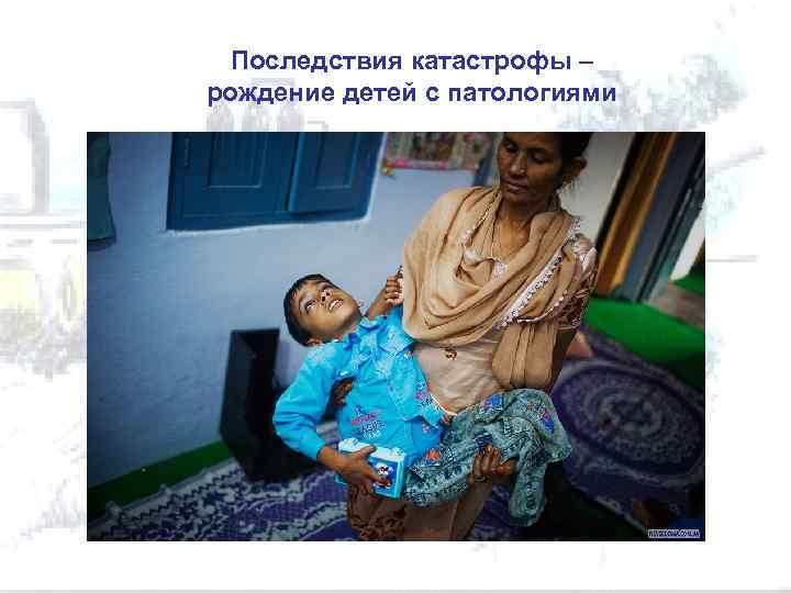 Последствия катастрофы – рождение детей с патологиями 