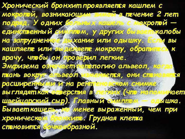 Хронический бронхит проявляется кашлем с мокротой, возникающим зимой в течение 2 лет подряд. У