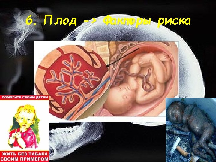 6. Плод -> Факторы риска 