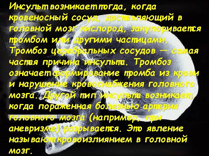 Инсульт возникает тогда, когда кровеносный сосуд, доставляющий в головной мозг кислород, закупоривается тромбом или