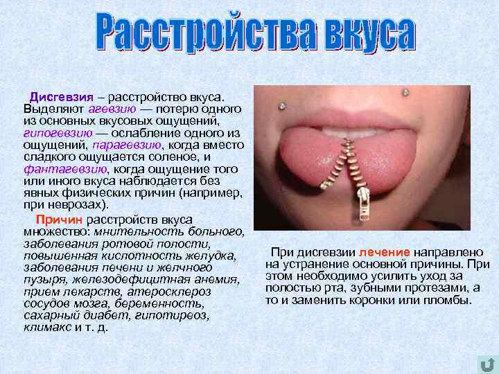 Дисгевзия – расстройство вкуса. Выделяют агевзию — потерю одного из основных вкусовых ощущений, гипогевзию