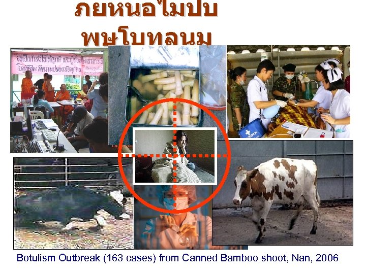 ภยหนอไมปบ พษโบทลนม Botulism Outbreak (163 cases) from Canned Bamboo shoot, Nan, 2006 