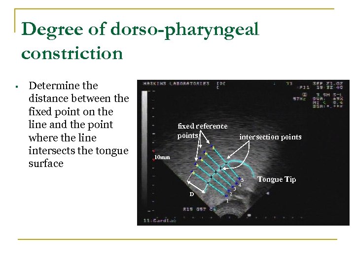 Degree of dorso-pharyngeal constriction § Determine the distance between the fixed point on the