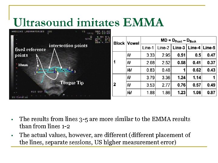 Ultrasound imitates EMMA fixed reference points 10 mm 2 1 intersection points 3 4