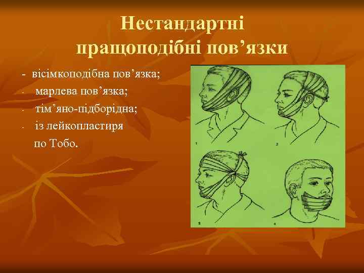 Нестандартні пращоподібні пов’язки - вісімкоподібна пов’язка; - марлева пов’язка; - тім’яно-підборідна; - із лейкопластиря