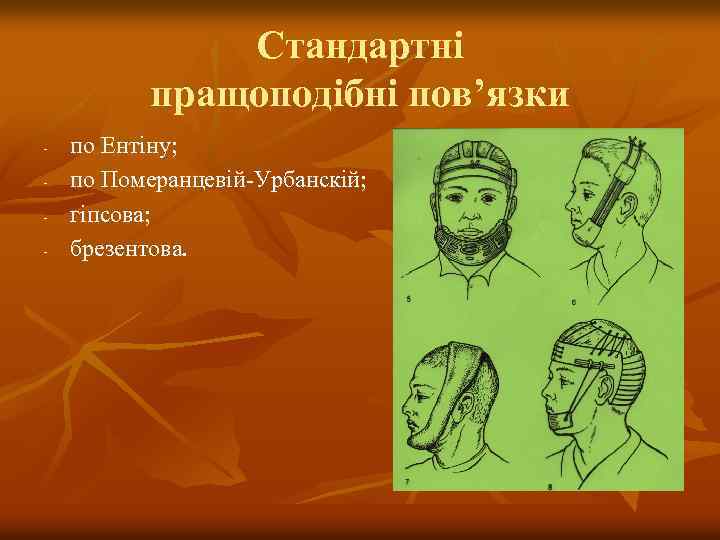 Стандартні пращоподібні пов’язки - по Ентіну; по Померанцевій-Урбанскій; гіпсова; брезентова. 