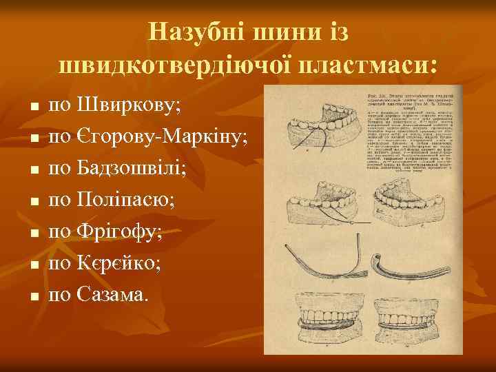 Назубні шини із швидкотвердіючої пластмаси: n n n n по Швиркову; по Єгорову-Маркіну; по