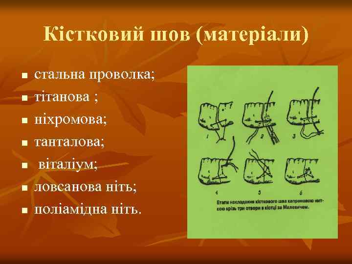 Кістковий шов (матеріали) n n n n стальна проволка; тітанова ; ніхромова; танталова; віталіум;